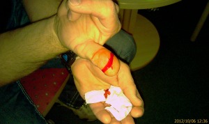 Helges Daumen... :-(